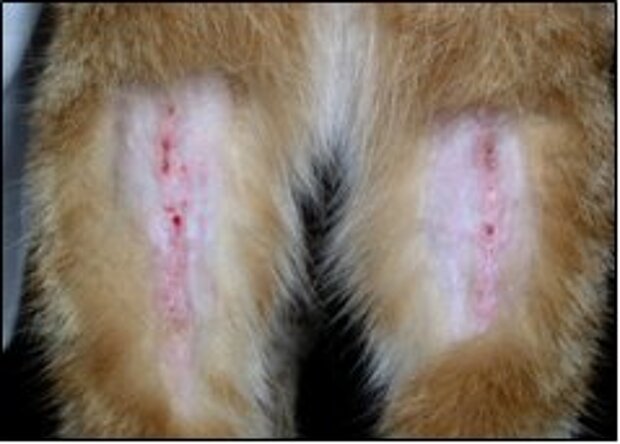 Lineares Granulom der hinteren Oberschenkel