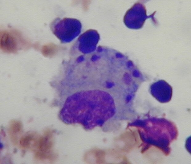Makrophage (Entzündungszelle) mit Leishmanien